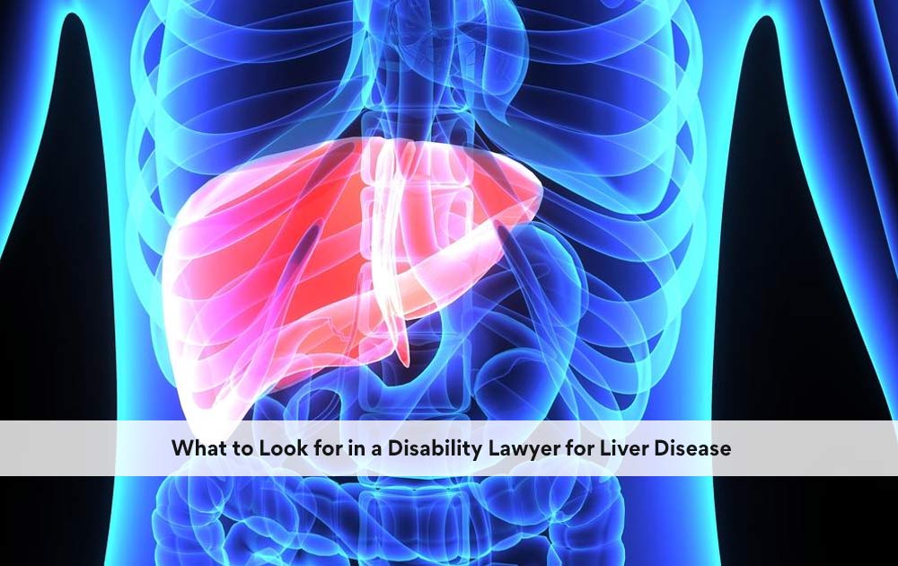 blog/2020/10/What-to-Look-for-in-a-Disability-Lawyer-for-Liver-Disease.jpg